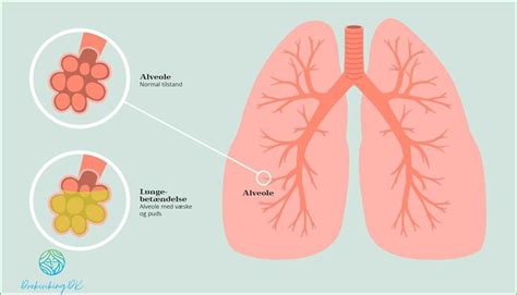 kan allergi ge feber