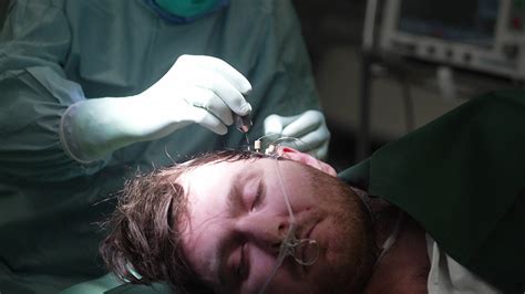 kan killar operera  mot fitta