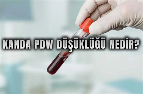 Kanda Pdw Nedir
