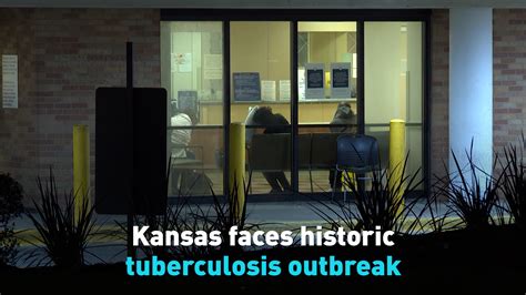 kansas tuberculosis