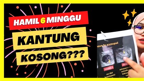 KANTUNG JANIN 4 MINGGU - PERKEMBANGAN JANIN 4 MINGGU