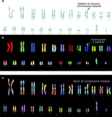 Karyotype Analysis Slides The Biology Corner Biology Karyotype Worksheet Answers Key - Biology Karyotype Worksheet Answers Key
