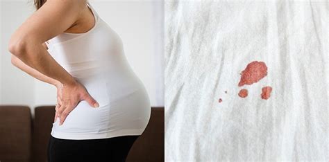 keluar darah saat hamil tua tapi belum kontraksi