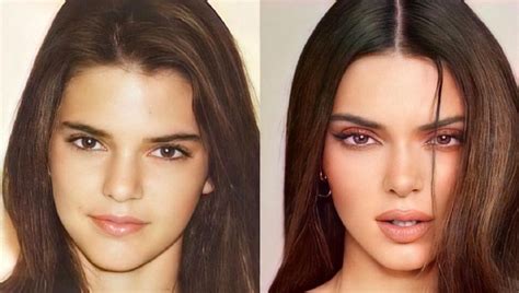 Kendall Jenner: Antes y después: La transformación de la supermodelo