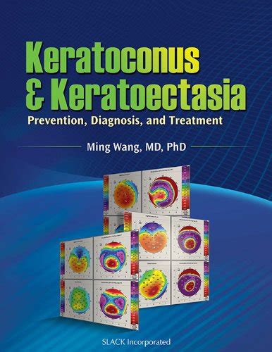 Download Keratoconus And Keratoectasia Prevention Diagnosis And Treatment Author Ming Wang Published On October 2009 