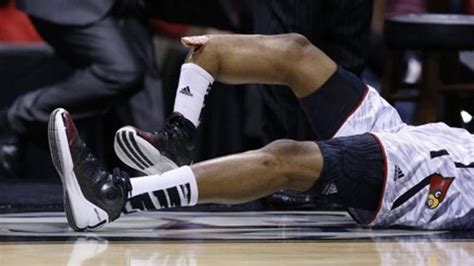Kevin Ware Lesion