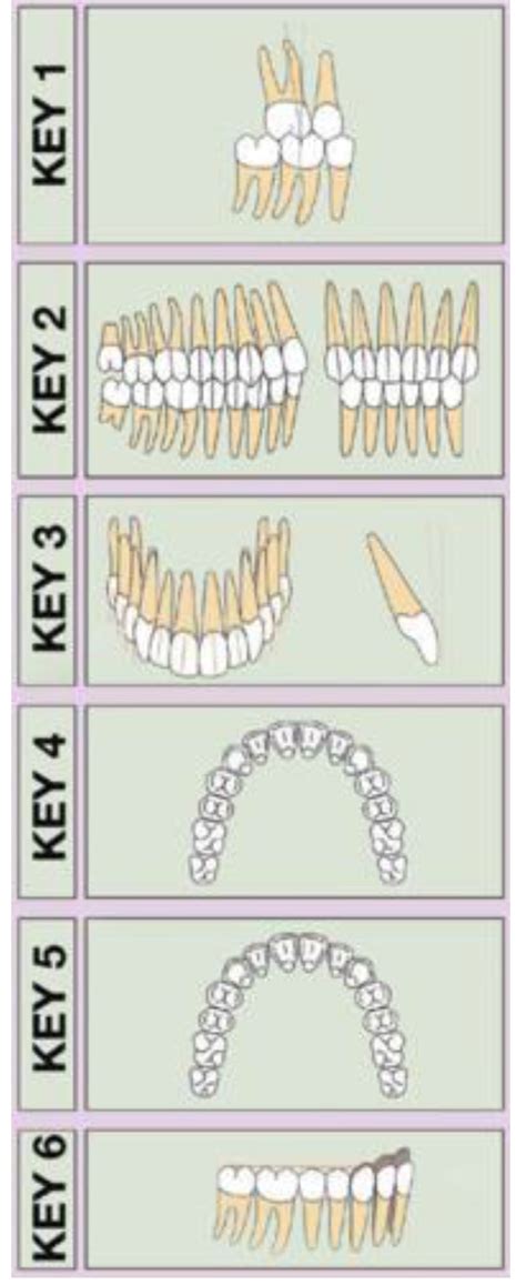 Key Of Occlusion