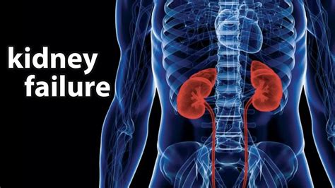 Kidney Failure  Causes  Symptoms   Treatment - Suspect Adalah