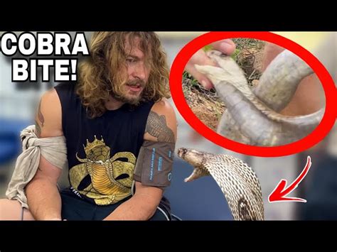 King Cobra Bite