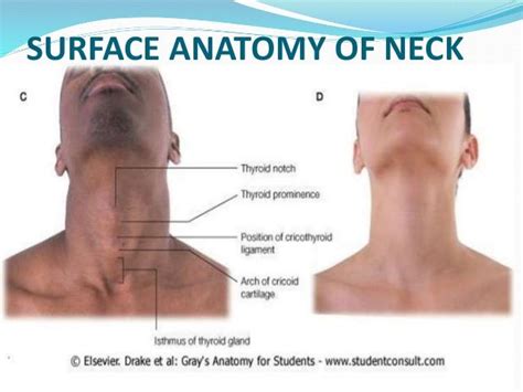 kissing neck description anatomy images