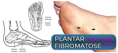 kliar under foten barn