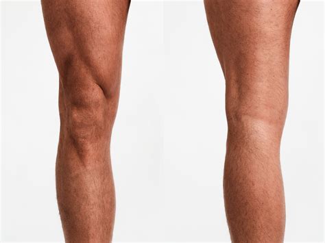 knä ur led övningar