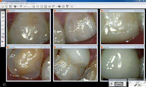 kodak dental imaging software v6 12 26