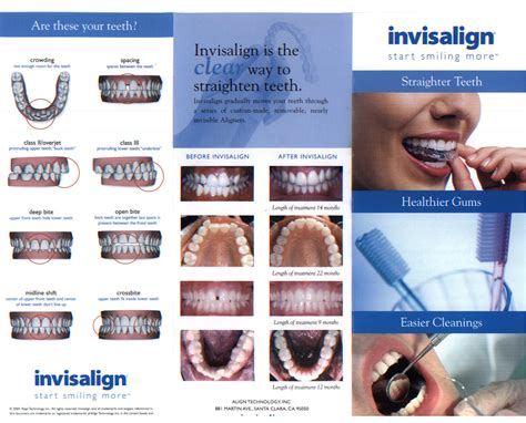 kodak invisalign template