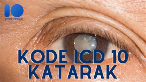 kode icd 10 katarak