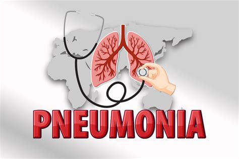 kode icd 10 pneumonia