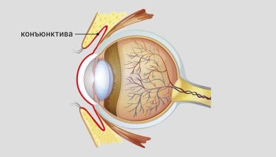 konjunktivit ogonkram