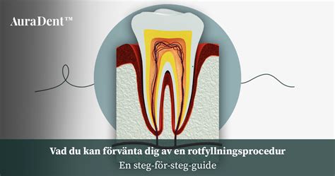 konserverande rotbehandling