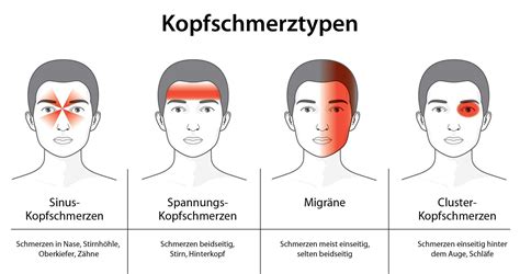 kopfschmerzen