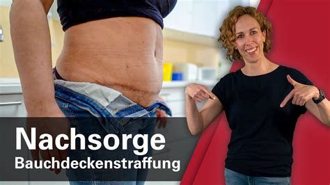 kosten für bauchstraffung im überblick