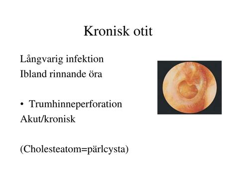 kronisk otit behandling