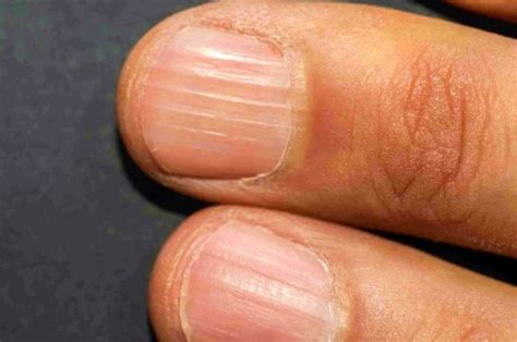 kuku bergaris | warna gi tt Thng 8 2025 Mua