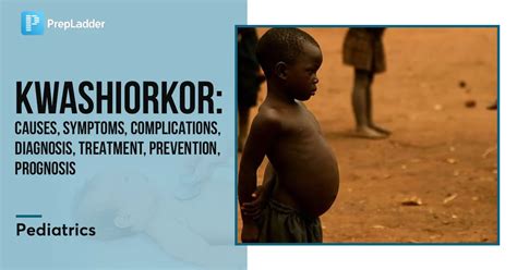 kwashiorkor symptomen