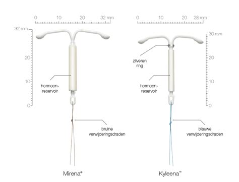 kyleena spiraal hoe lang