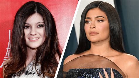 Kylie Jenner Before