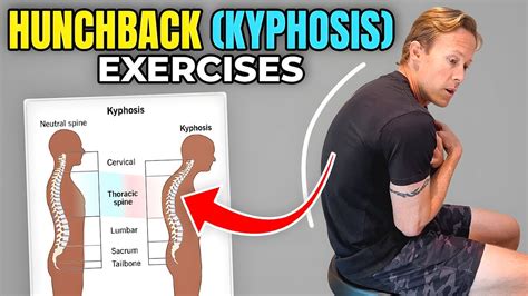 Kyphosis Exercise