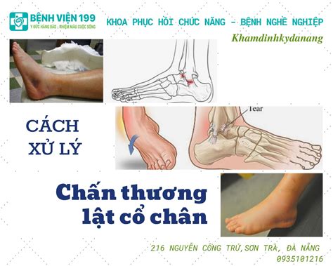 lật cổ chân | Lt s mi c chn l g
