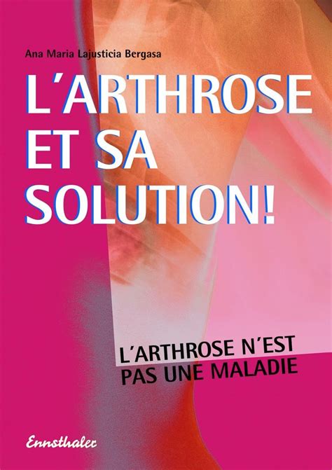 l arthrose et sa solution