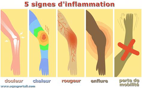 l inflammation