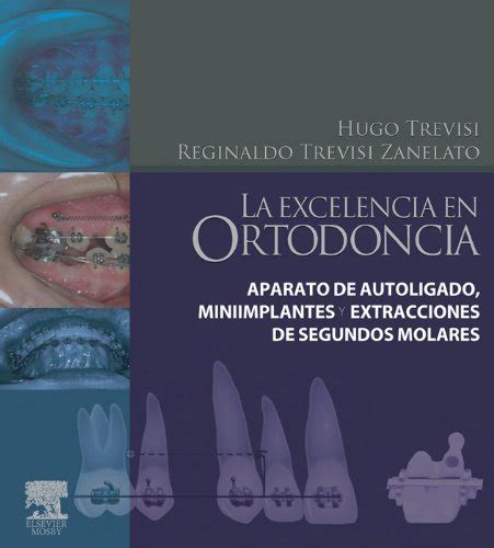 Download La Excelencia En Ortodoncia Aparato De Autoligado Miniimplantes Y Extracciones De Segundos Molares Spanish Edition 