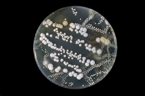Lab 3 Bacterial Growth Introductory Bacteriology Lab Manual Growing Bacteria Lab Worksheet - Growing Bacteria Lab Worksheet