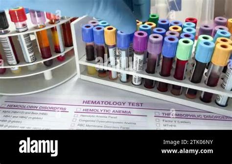 lab techniques hematology