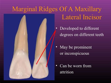 Lateral Maxillary Incisor