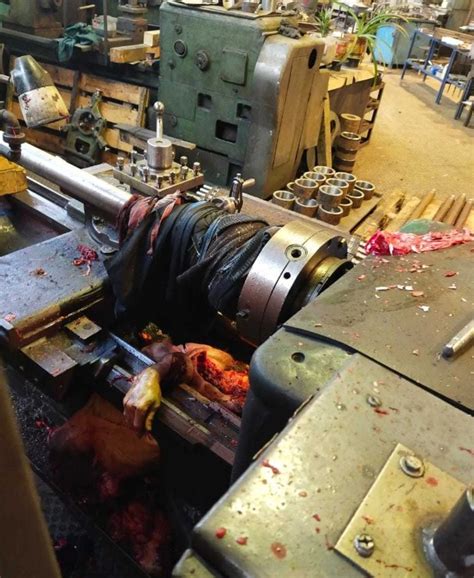 Lathe Machine Incident