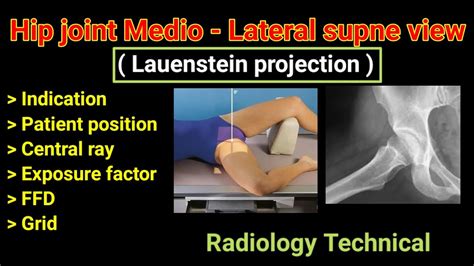 Lauenstein Projection