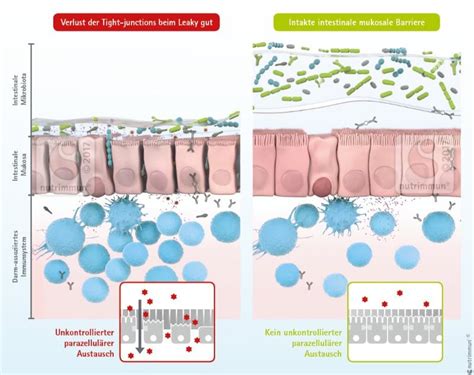 leaky gut der durchlassige darm allergien nahrung