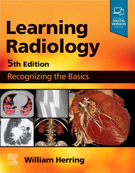 Learning Radiology William Herring
