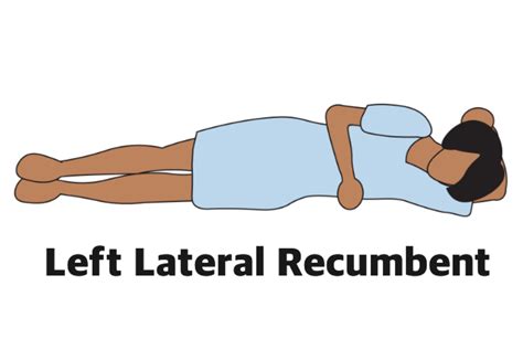 Left Lateral Recumbent