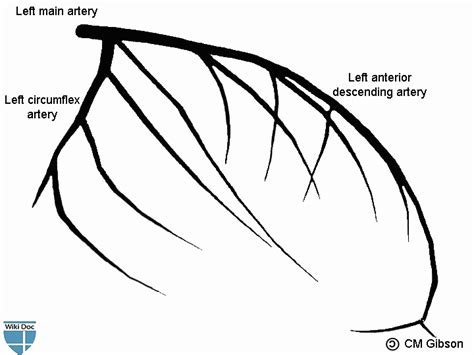 left main artery