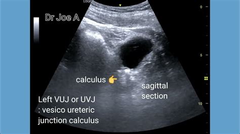 Left Vuj Calculus