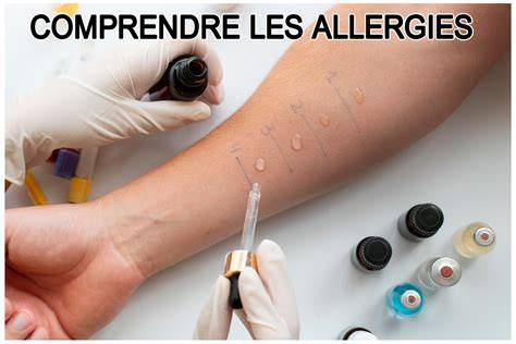 les allergies connaa tre comprendre optimiser