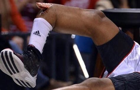 Lesion De Kevin Ware