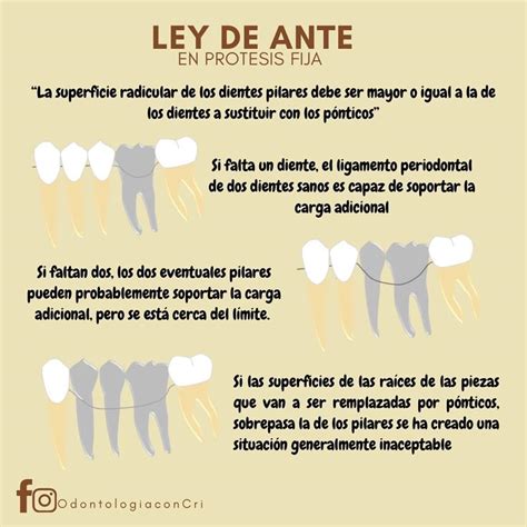 Ley De Ante