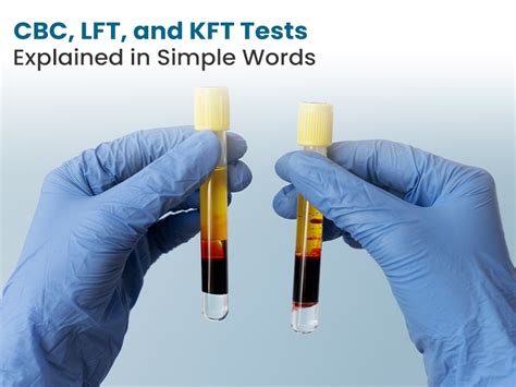 Lft Kft Test