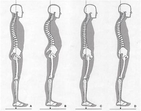 lichaamshouding analyse