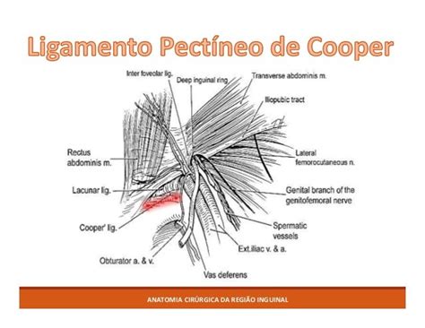 Ligamento De Cooper